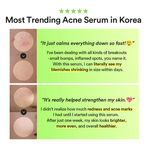 Heartleaf TECA Capsule Serum Calming Drop - 50ml