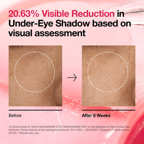 Before and after comparison of under-eye shadow reduction with text on a pink background