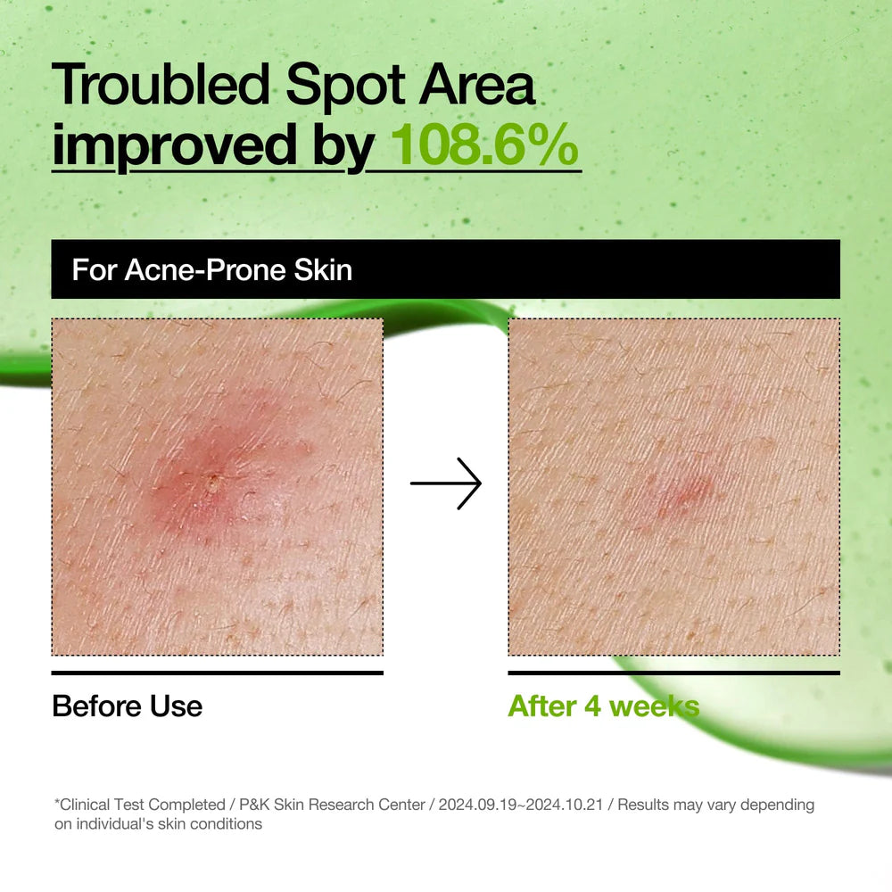 Azelaic Acid 10 Hyaluron Redness Soothing Serum - 30ml