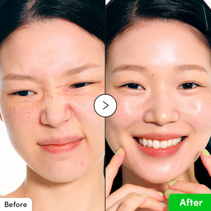 Aloe PDRN Calming Serum - 30ml