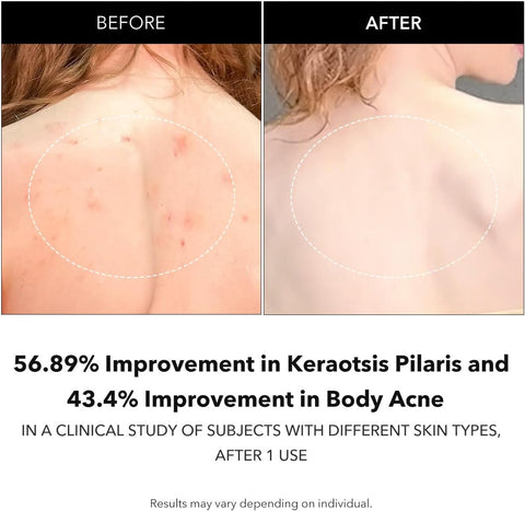 Carrotene IPMP™ Exfoliating Body Wash - 300ml