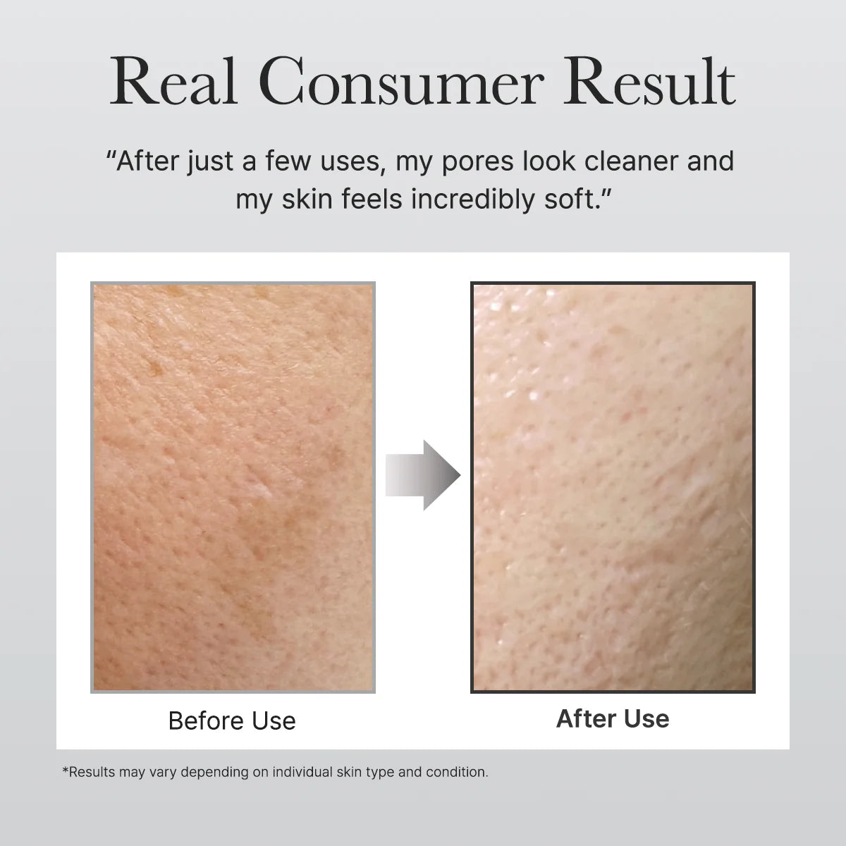 Before and after skin comparison showing cleaner pores and softer skin texture.