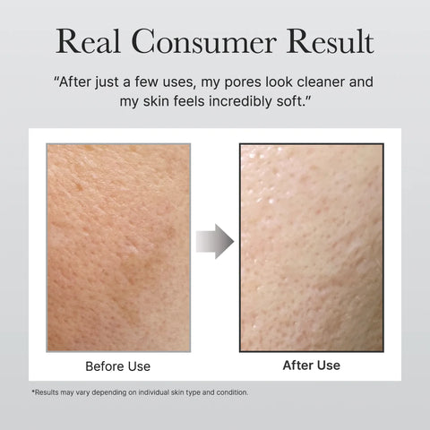 Before and after skin comparison showing cleaner pores and softer skin texture.