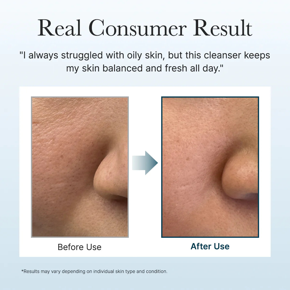 Soothing rice cleanser tube displayed beside its packaging.