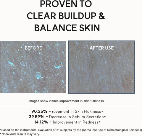 Eraser Shot Glycolic Acid Booster - 30ml