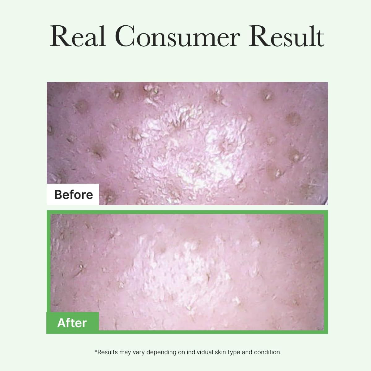 Pore Melt Mochi Cleansing Oil - 200ml