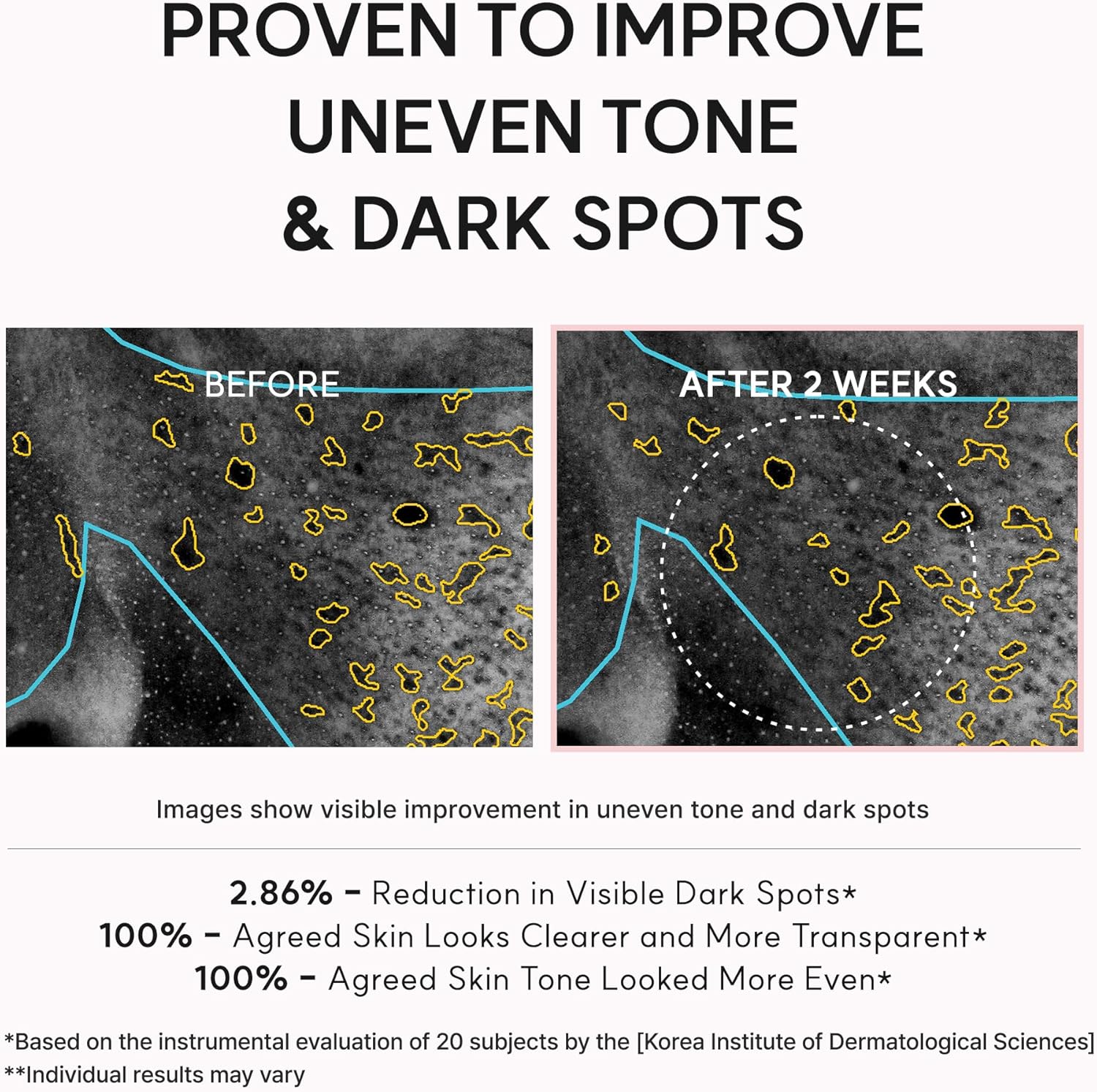 TXA Booster Shot - 30ml