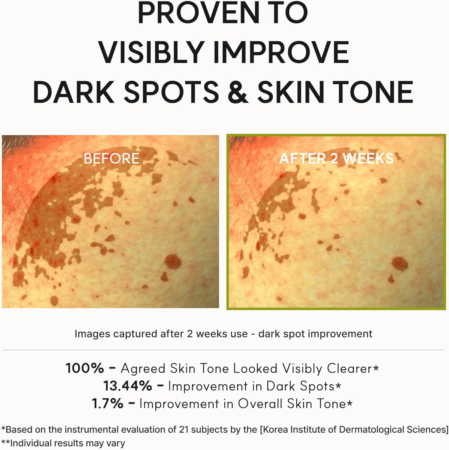 Vitamin C Booster Shot - 30ml