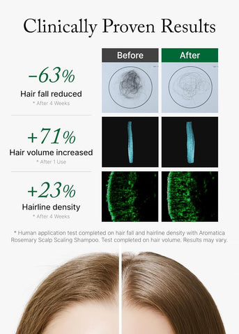 Rosemary Scalp Scaling Shampoo - 400ml
