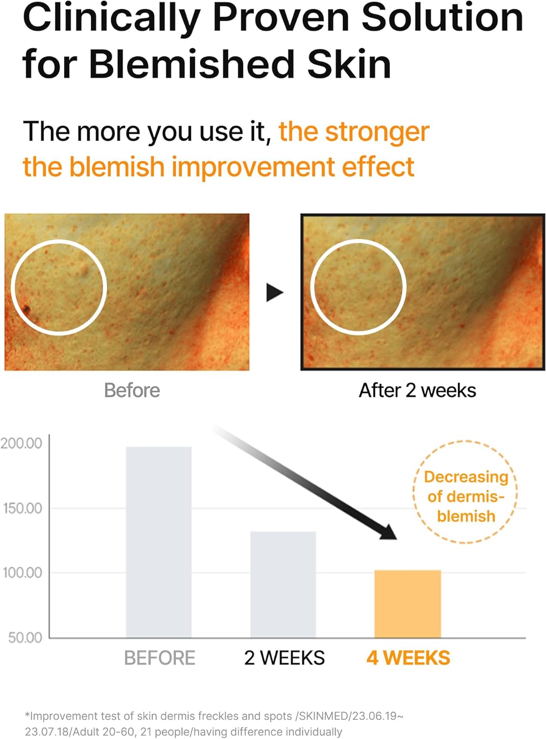 Before and after dark spot results using Celimax serum Noura Skincare