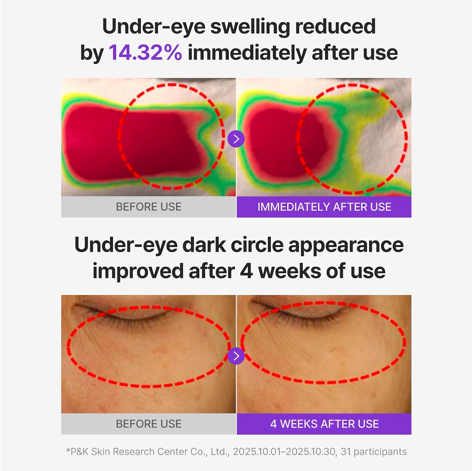 360º Shot PDRN Glowing Eye Patch - 6 Pairs
