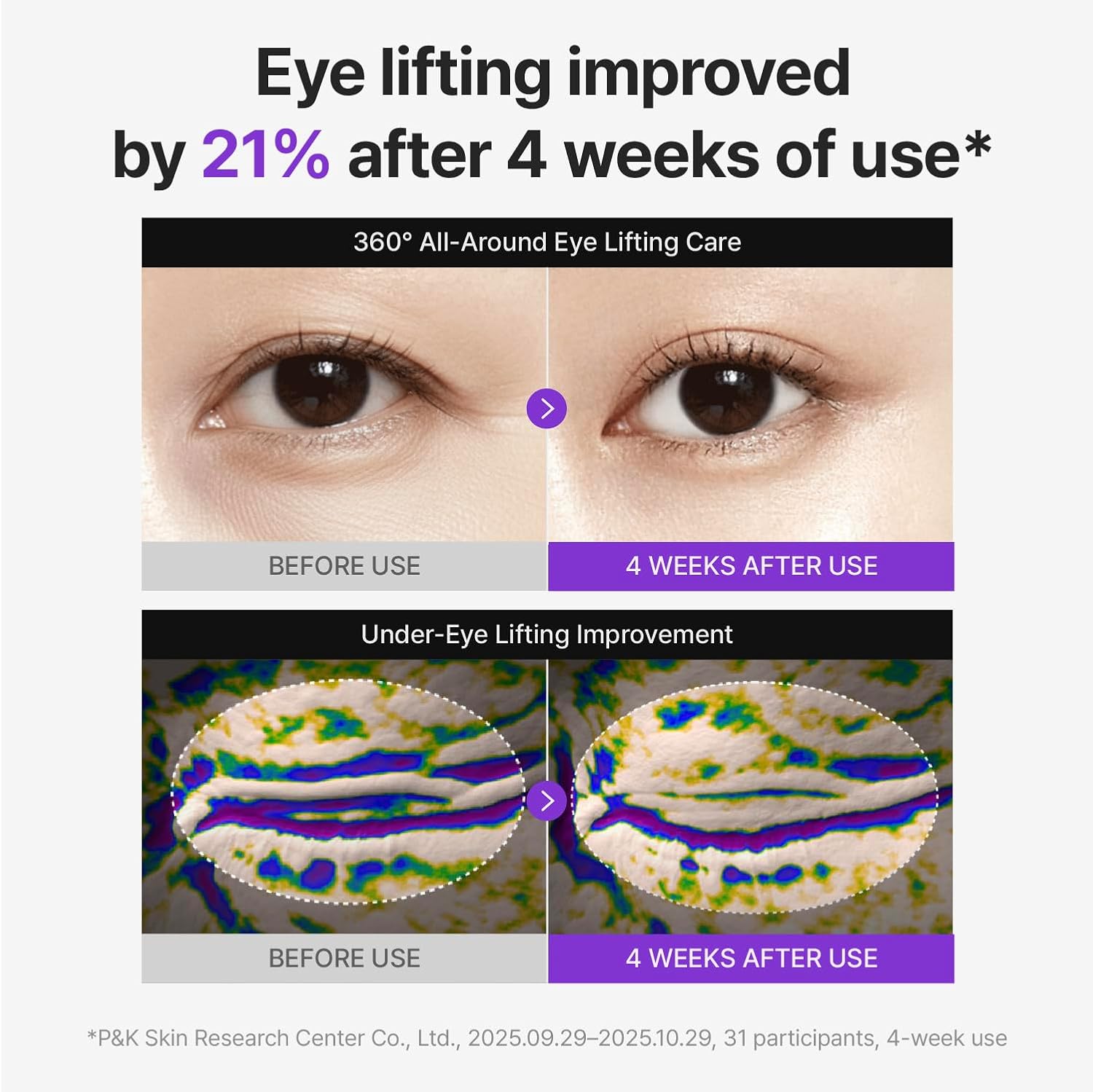360º Shot PDRN Lifting Eye Cream - 30ml