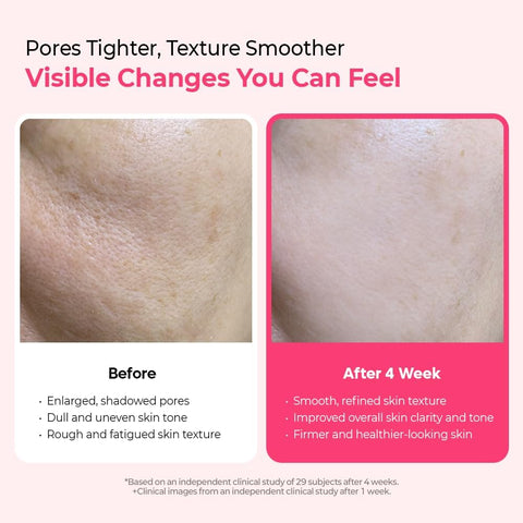 Cemenrete Cyano Pink Spicule Serum - 30ml