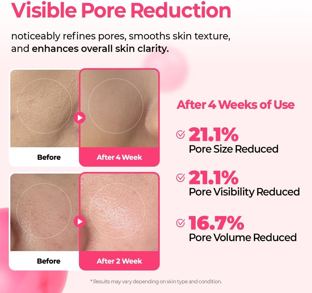 Cemenrete Cyano Pink Spicule Serum - 30ml