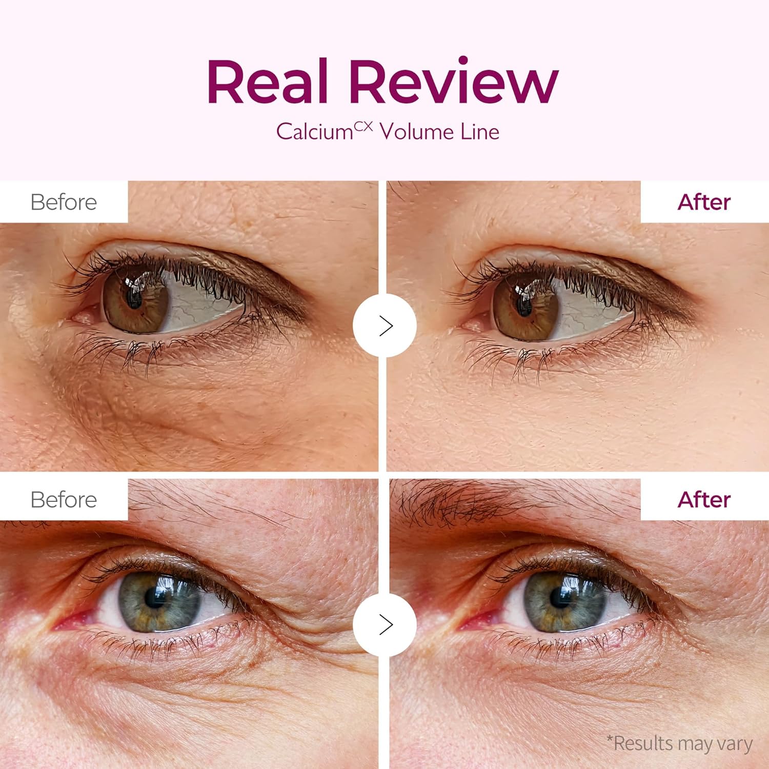 Cemenrete Calcium Volume Eye Patch - 60pcs