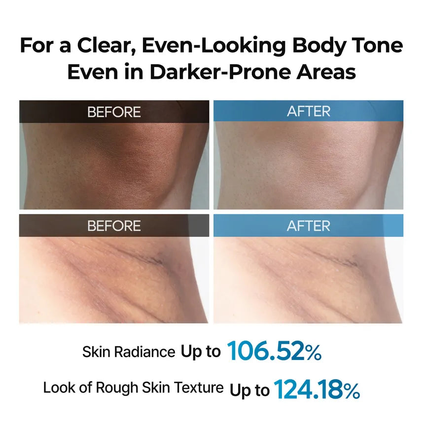 Exfoliating TX Spray - 200ml