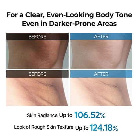 Exfoliating TX Spray - 200ml
