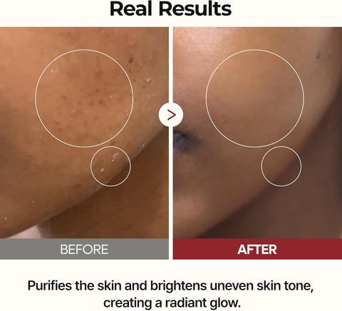 Glow White Rice Toner - 200ml