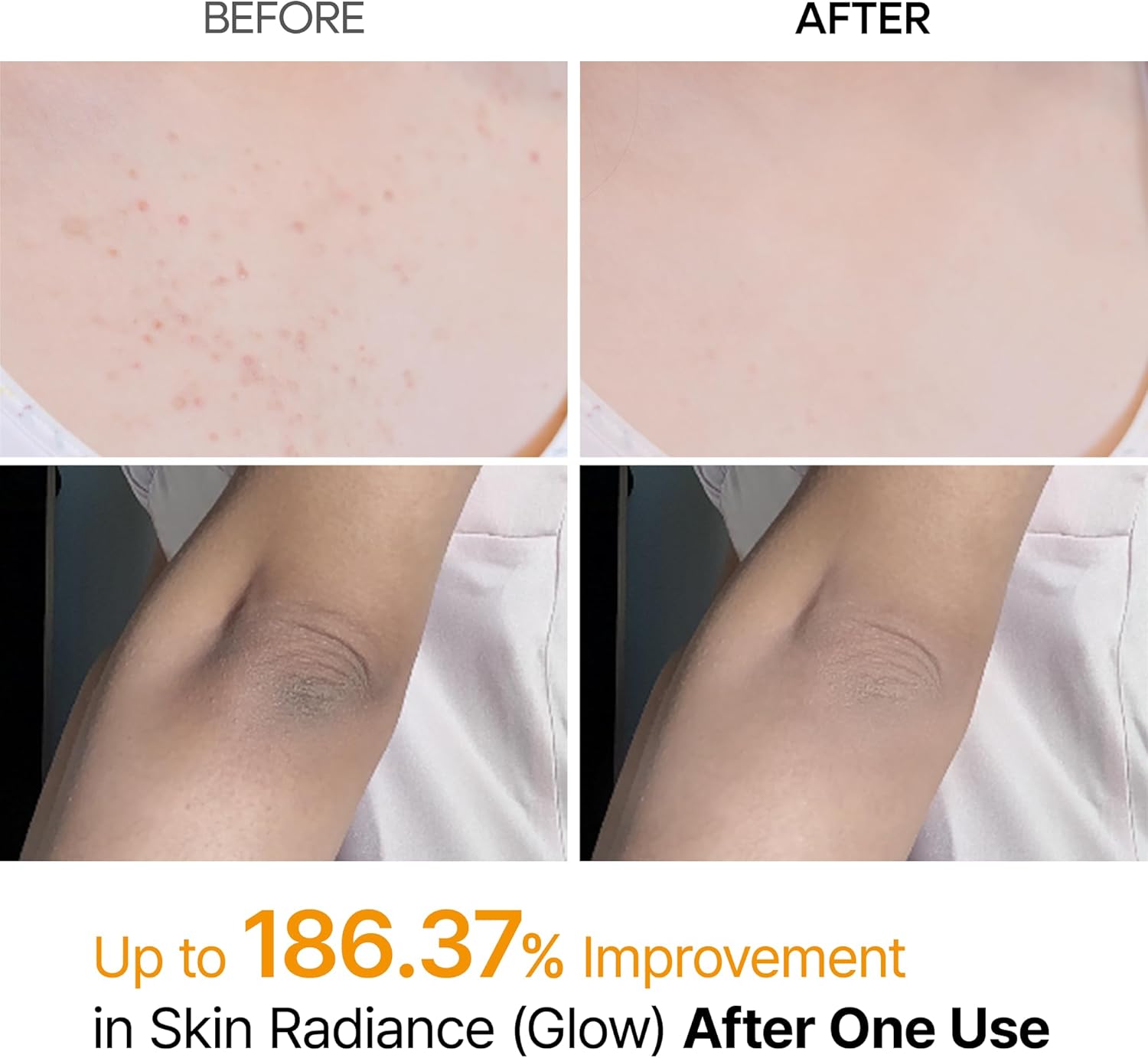 Exfoliating Kojic Acid Turmeric Spray - 200ml