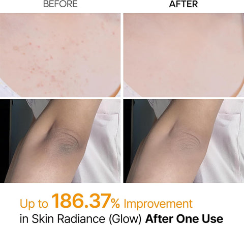 Exfoliating Kojic Acid Turmeric Spray - 200ml