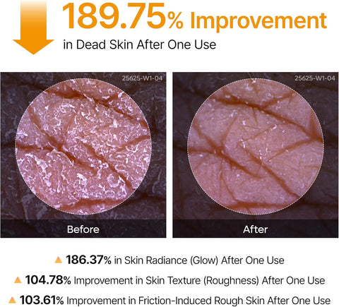 Exfoliating Kojic Acid Turmeric Spray - 200ml