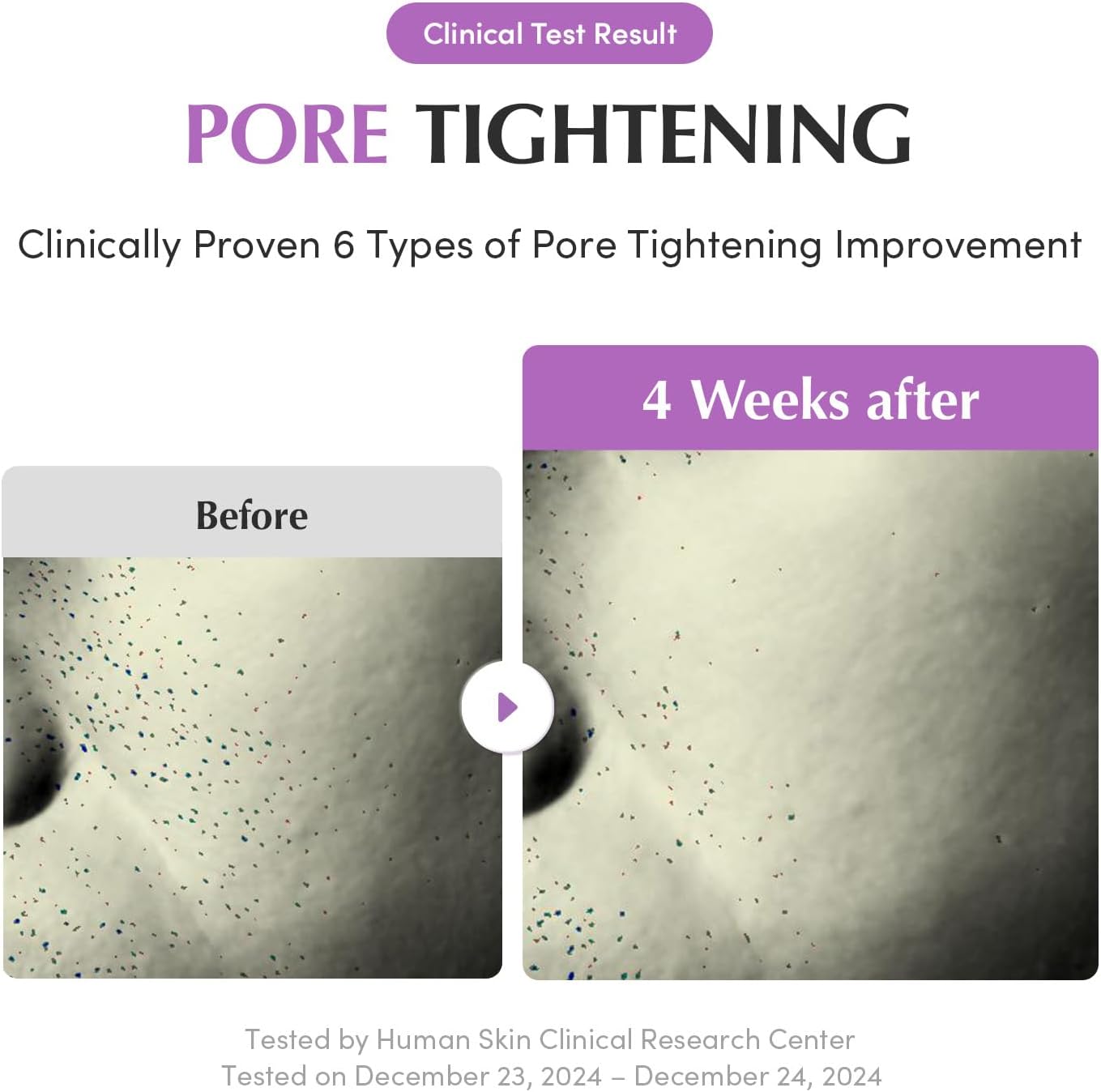 Purple PDRN Pore Minimizing Serum - 30ml