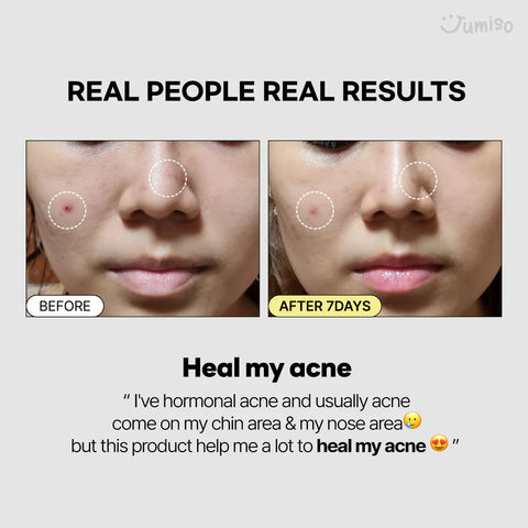 Snail Mucin 95% + Peptide Essence - 50ml