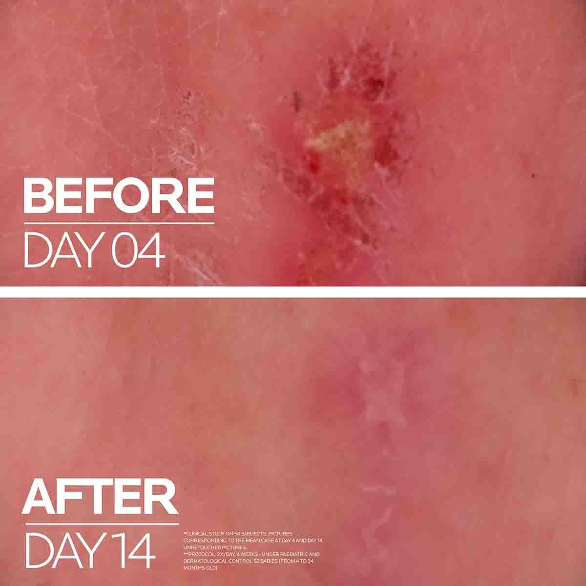 Cicaplast Balm B5 Multi-Purpose Repairing Balm - 40ml