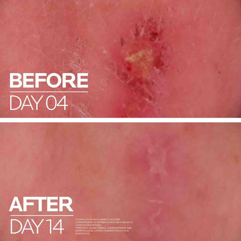 Cicaplast Balm B5 Multi-Purpose Repairing Balm - 40ml
