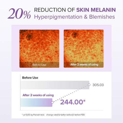 Tranexamic Acid + Glutathione Eye Cream - 30g