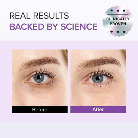 Tranexamic Acid + Glutathione Eye Cream - 30g