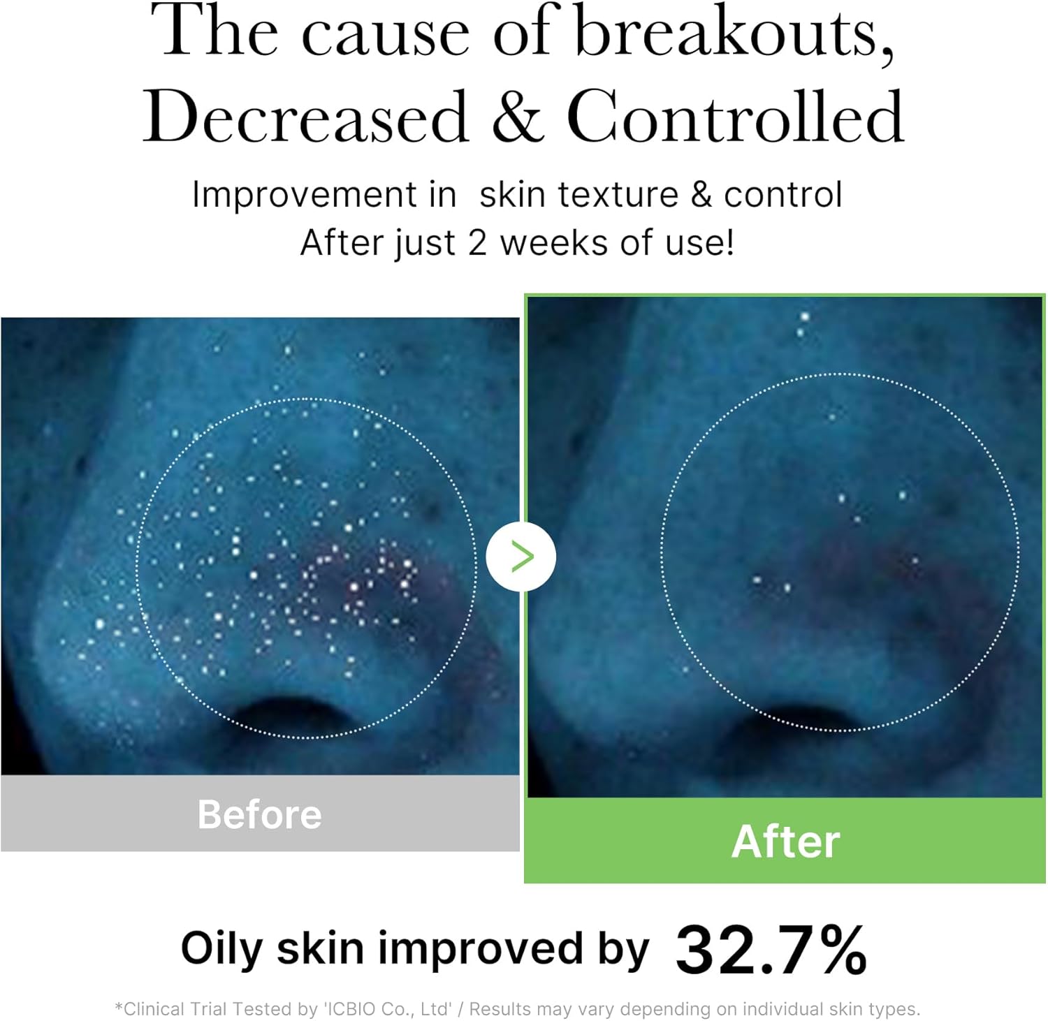 Before and after comparison of oily skin improvement with text indicating 32.7% improvement after 2 weeks.