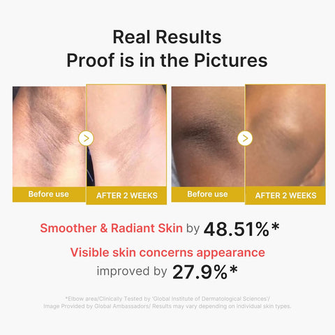Kojic Acid Turmeric Body Peel Shot - 280ml