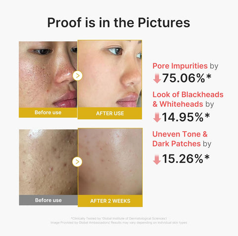 Kojic Acid Turmeric Face Peel Shot - 80ml