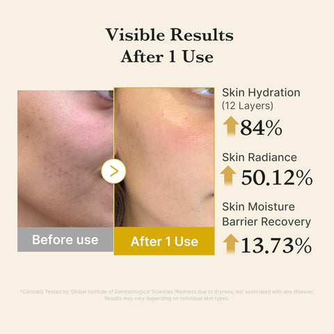 Kojic Acid Turmeric Vita Jelly Mist Serum- 100ml