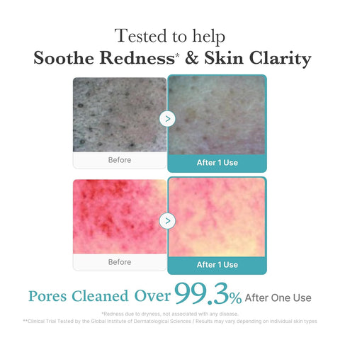 Before and after effects of a Medicue skincare product on skin texture and redness.