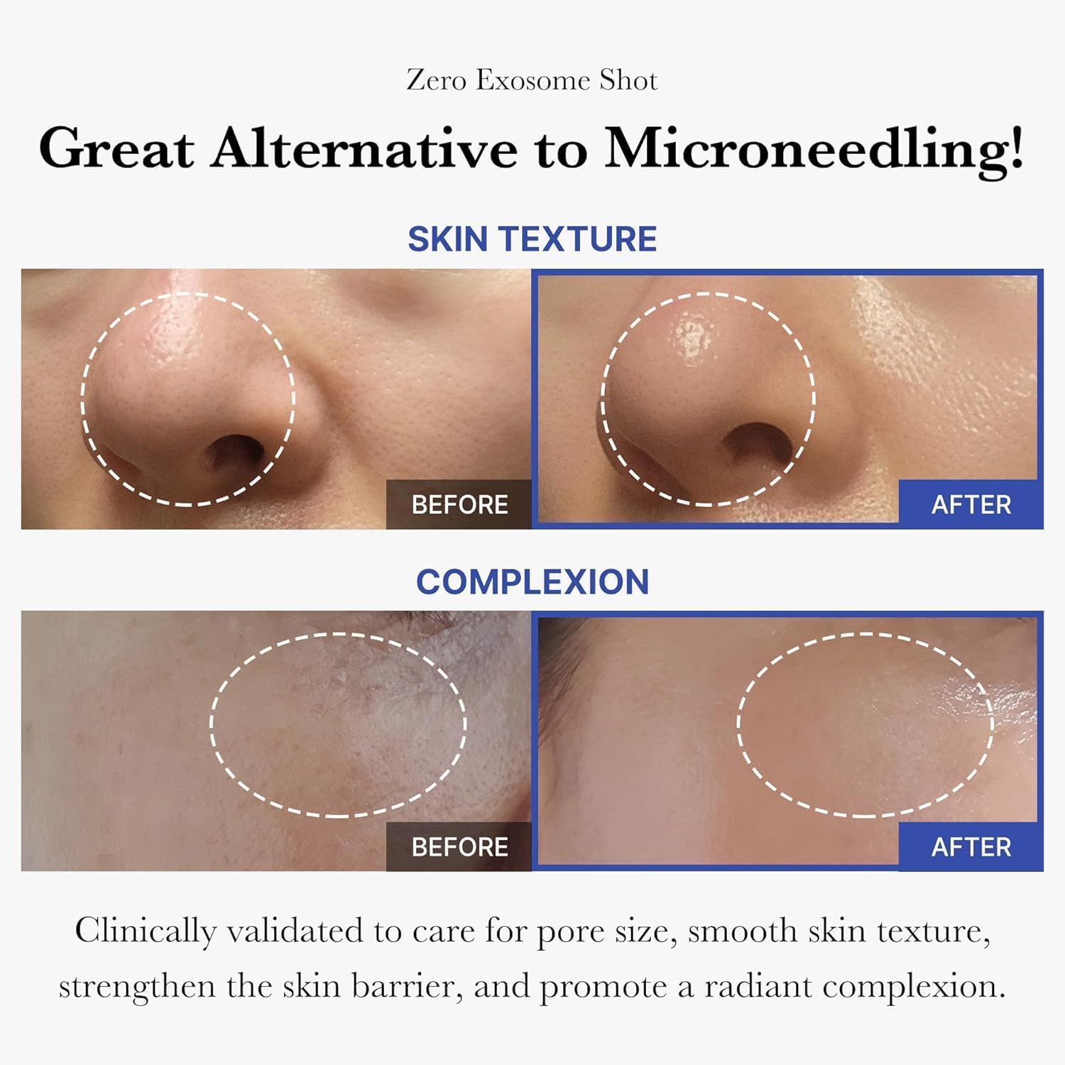 Before and after comparison of skin texture and complexion with text highlighting benefits by nouraskincare.