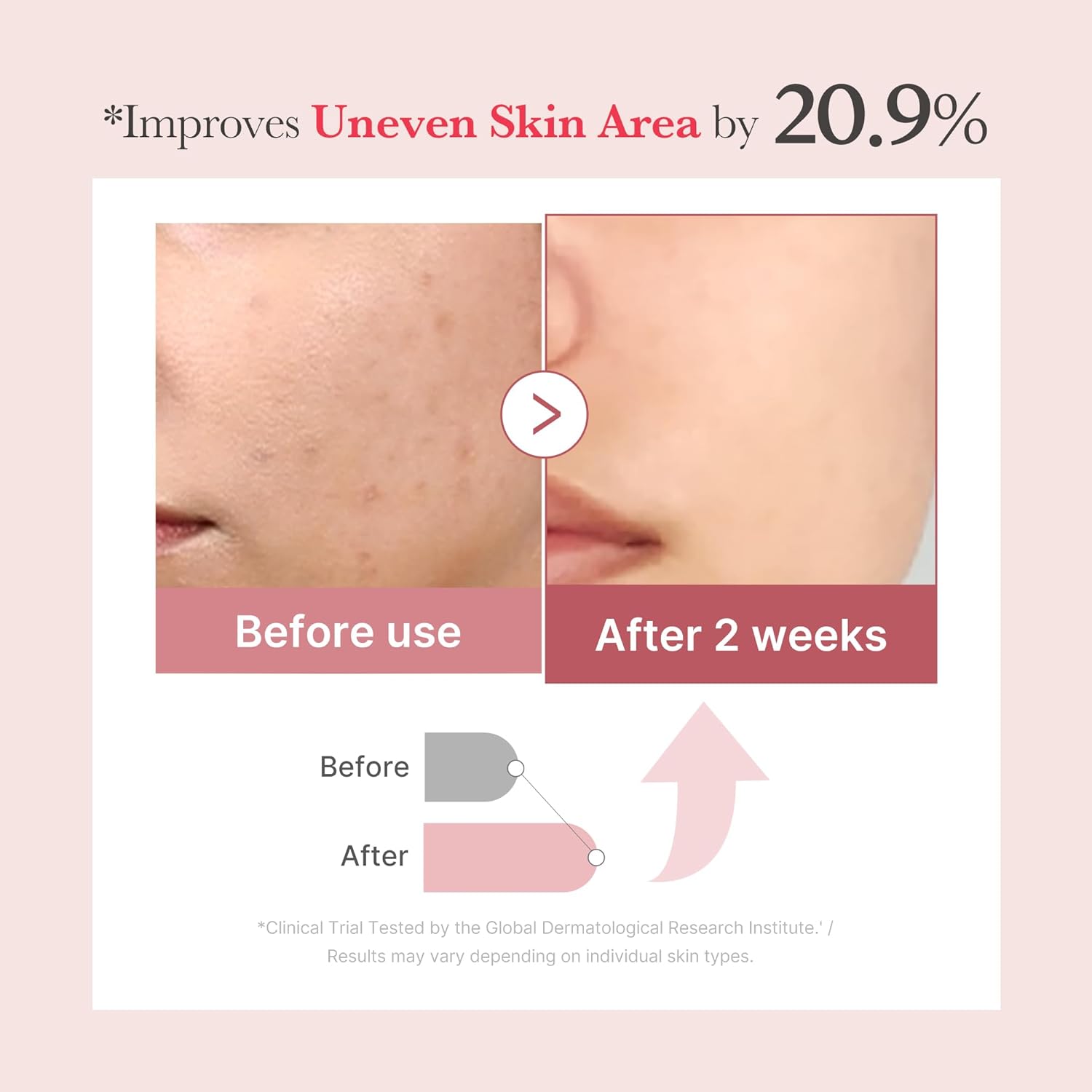 Before and after skin improvement showing 20.9% improvement in uneven skin area with a clinical trial result from the Global Dermatological Research Institute.