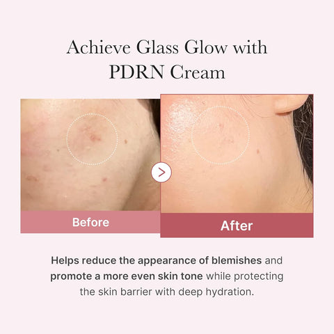 Before and after comparison of PDRN Cream on skin with text highlighting benefits.