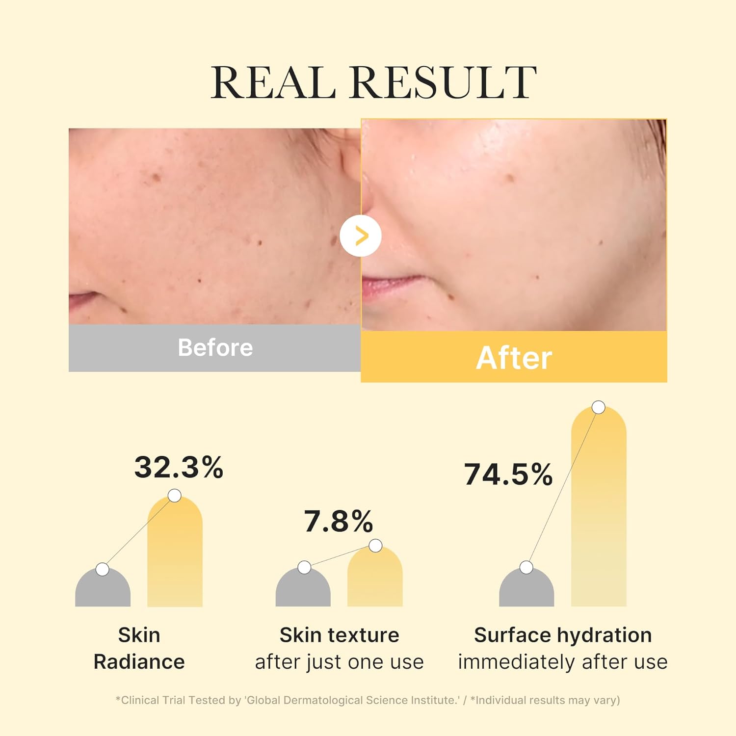 Kojic Acid Turmeric Gel Mask - 4ea