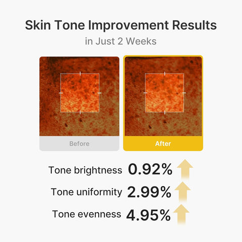 Kojic Acid Turmeric Vita Capsule Cream - 53g