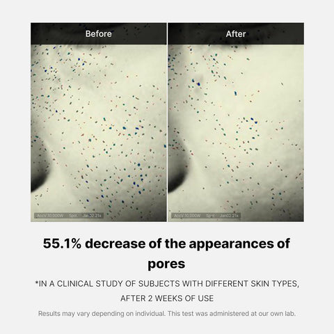 Before and after comparison of skin texture with text indicating pore reduction.