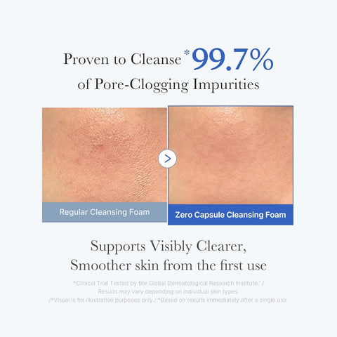 Zero Pore SA Clear Capsule Cleansing Foam - 120g