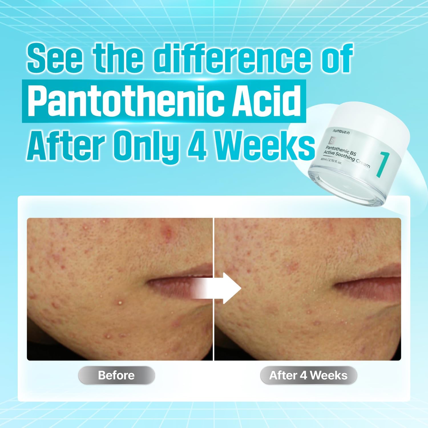 No.1 Pantothenic B5 Active Soothing Cream - 80ml