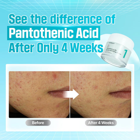 No.1 Pantothenic B5 Active Soothing Cream - 80ml