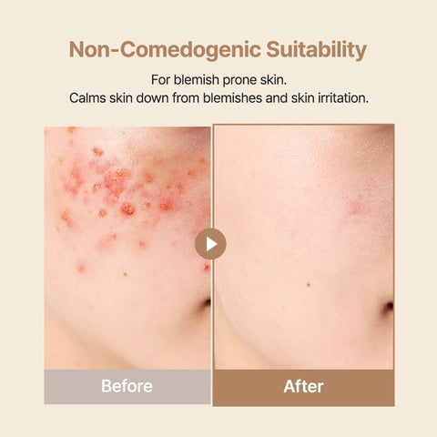 Oat-in Calming Gel Cream - 100ml