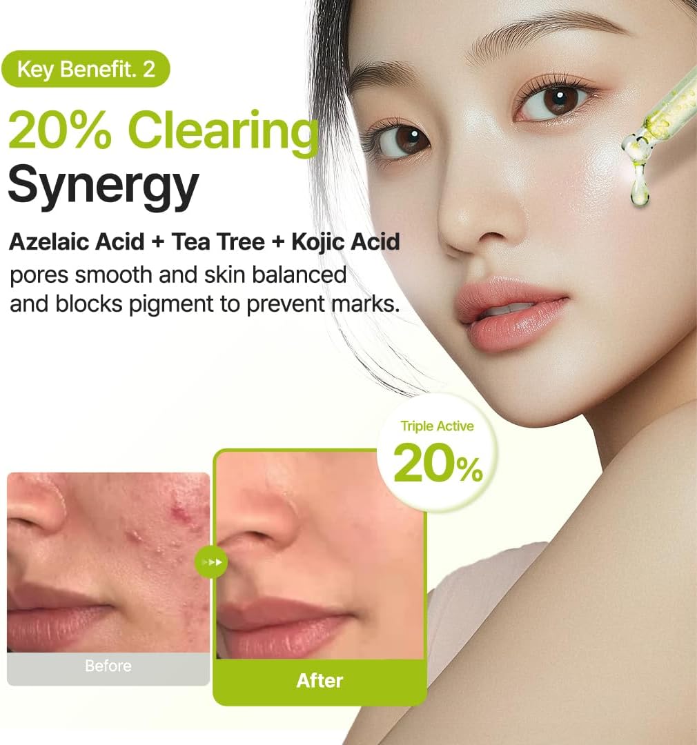 Azelaic Acid 10 Kojic Tea Tree Serum - 30ml