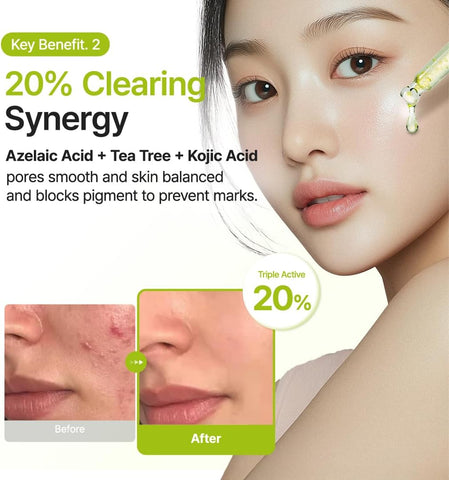 Azelaic Acid 10 Kojic Tea Tree Serum - 30ml