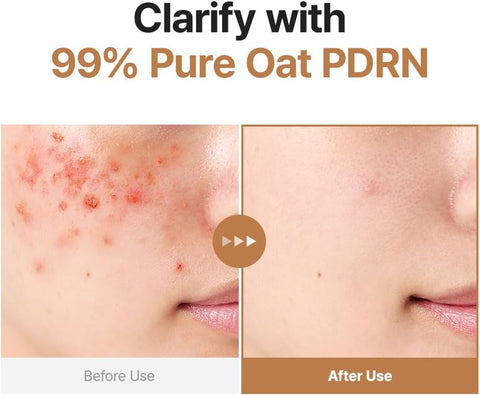Oat PDRN Gentle Refining Toner - 200ml
